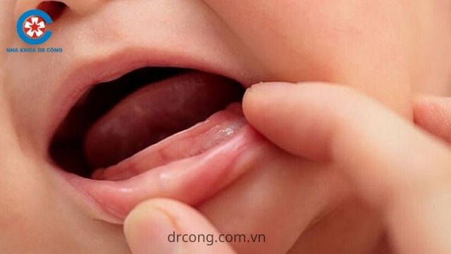 Làm Thế Nào Khi Trẻ Chậm Mọc Răng