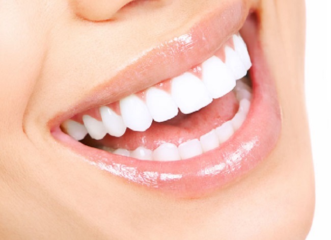 Phủ Trắng Răng là gì? Phủ Trắng Răng Nano Có Tốt Không?