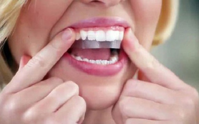 Cách tẩy trắng răng bằng miếng dán