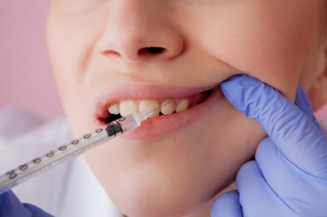 Giải Đáp: Có Kinh Lấy Tuỷ Răng Được Không?