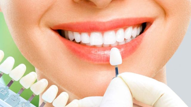 Bọc răng sứ có chữa móm được không