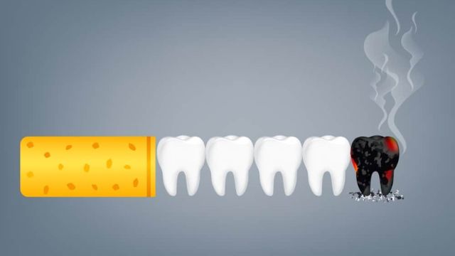 Hút thuốc lá ảnh hưởng đến răng miệng như thế nào