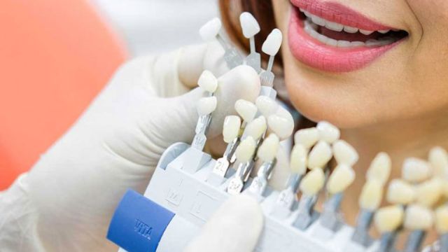 Phương pháp chỉnh răng hô không cần niềng