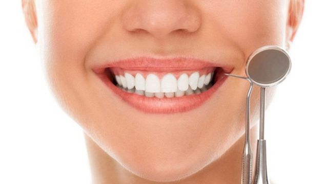 Phẫu thuật cắt chóp răng là gì